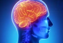 Emory stroke team part of NIH network