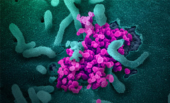 COVID-19 virus