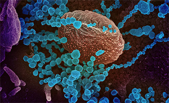 COVID-19 virus