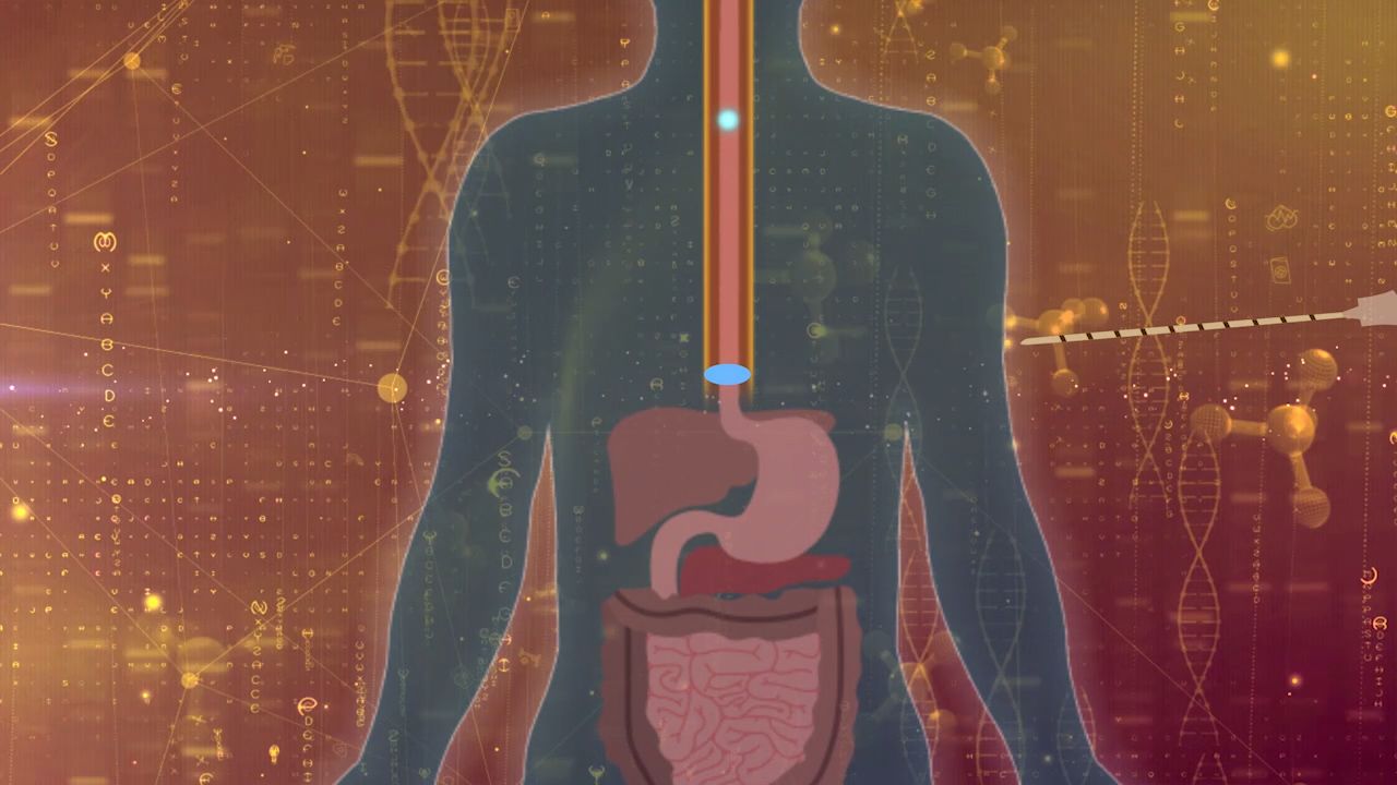 An illustration of the "hunger nerve" and the area targeted for freezing.