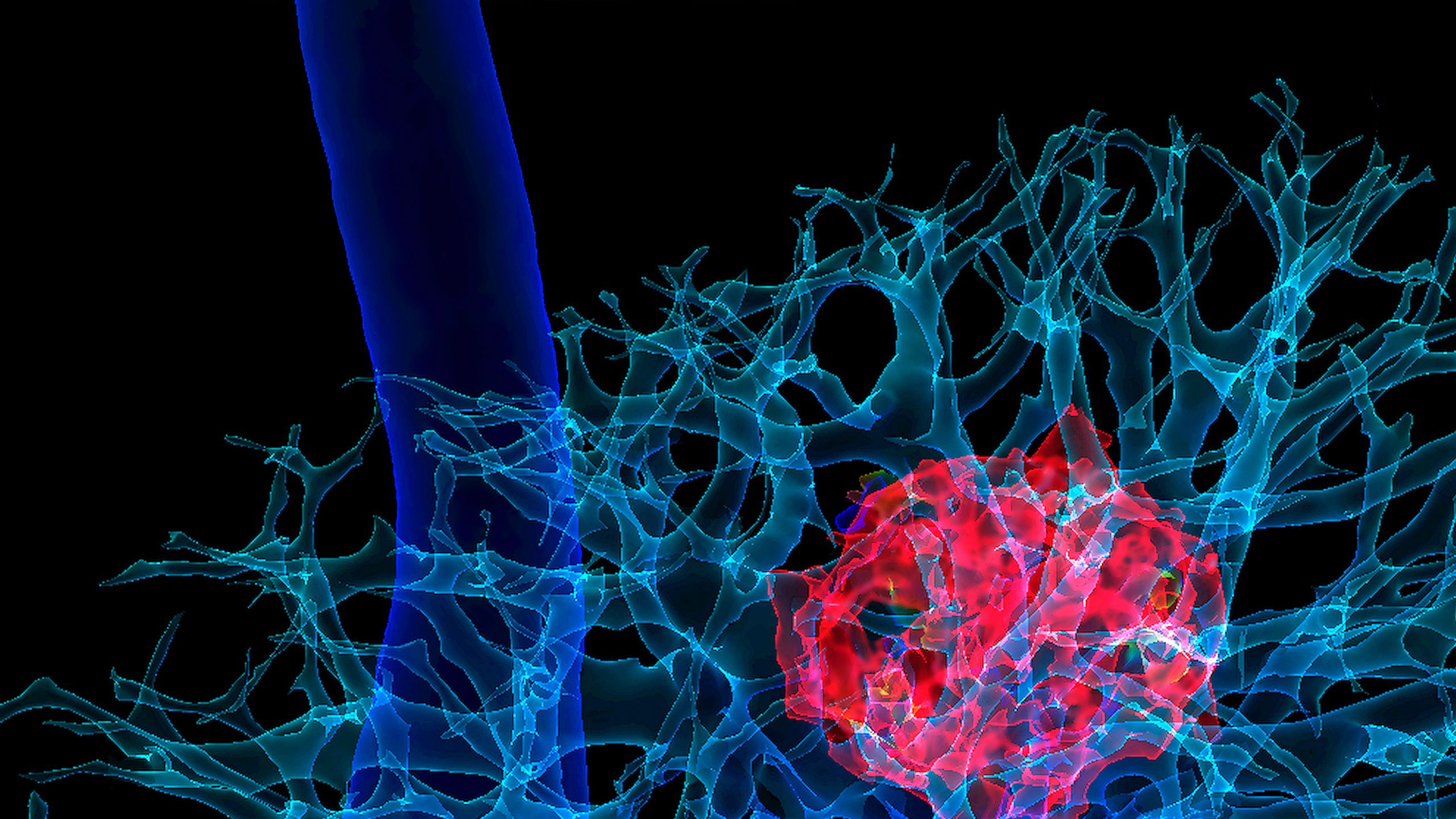 A stock image of body imaging, showing a red mass within blue and aqua circulatory networks. 