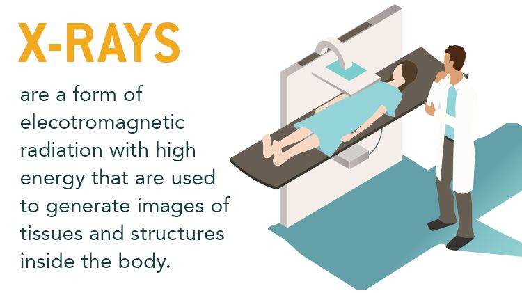 An illustration of a doctor standing beside a patient on a table under an X-ray machine, with the caption: X-rays are a form of electromagnetic radiation with high energy that are used to generate images of tissues and structures inside the body.