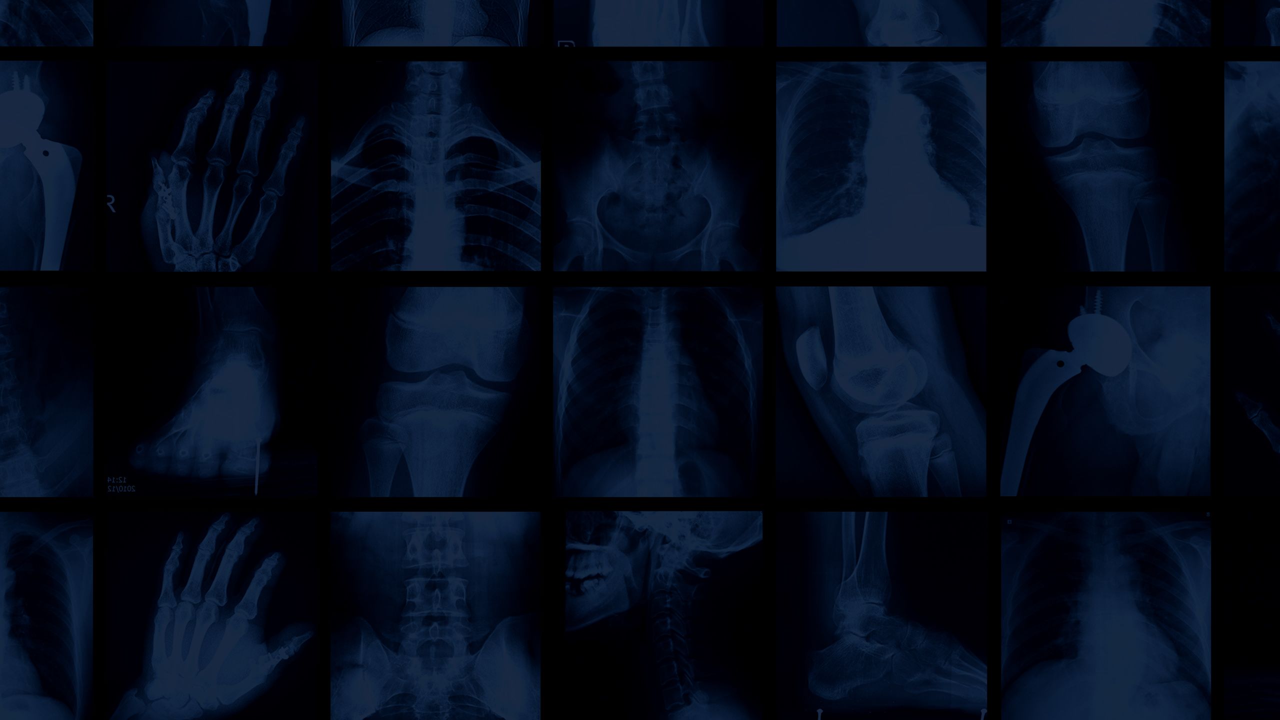 Faded background of orthopedic imaging on black.