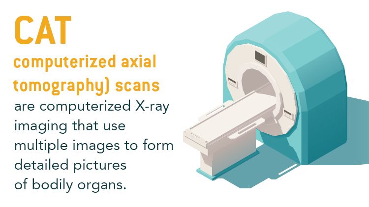 An illustration of a circular CT or CAT machine with the caption: CAT computerized axial tomography scans are computerized X-ray imaging that use multiple images to form detailed pictures of bodily organs.