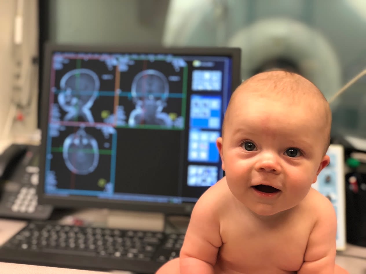 A baby with images of its brain.