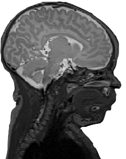 An fMRI scan of a newborn's brain.