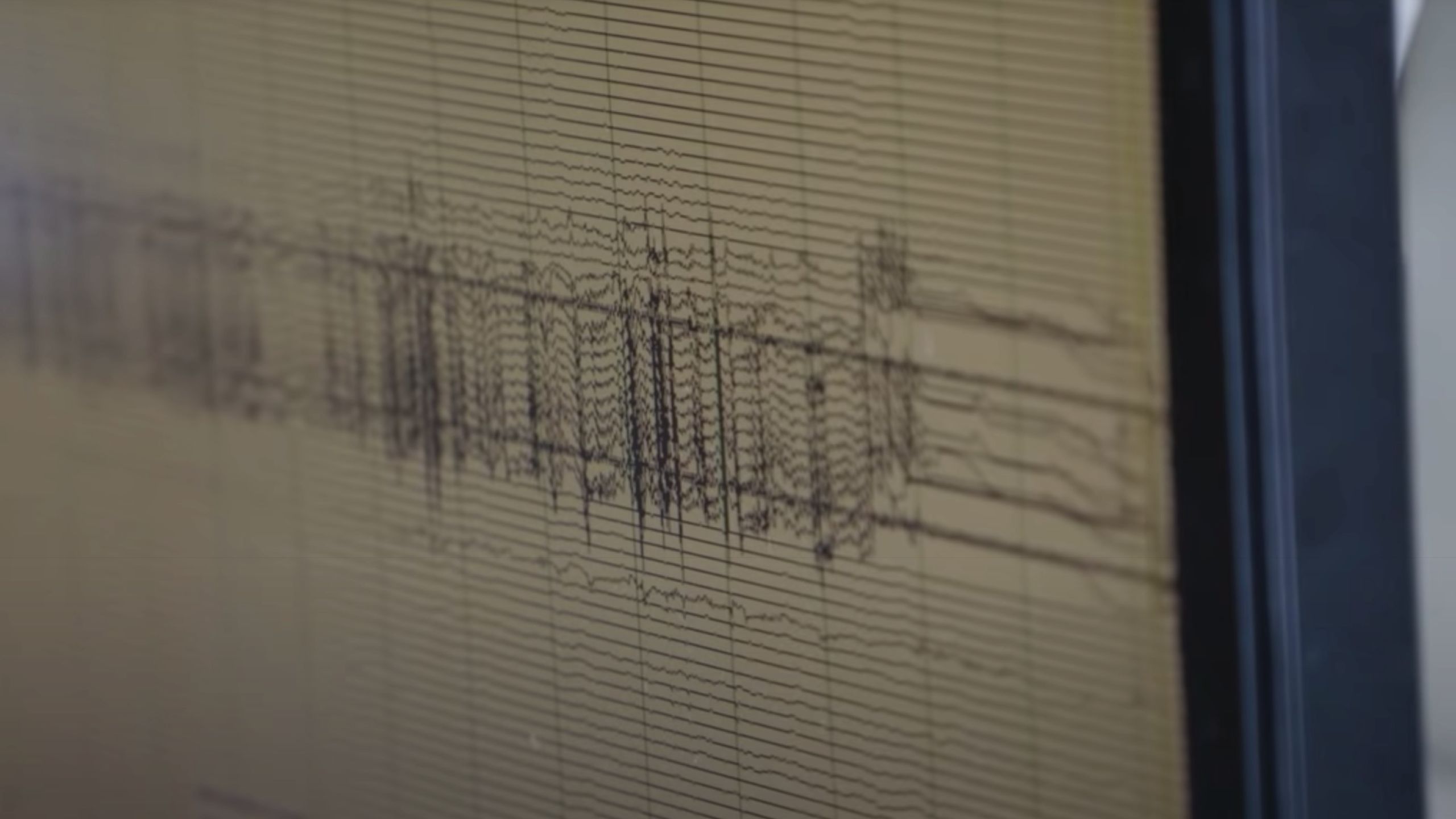 Brain waves being monitored by a doctor.