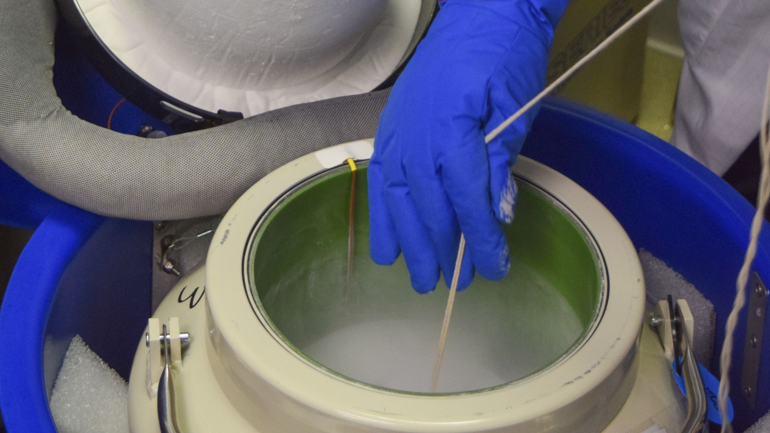 Photo series illustrating the CAR T-cell therapy process