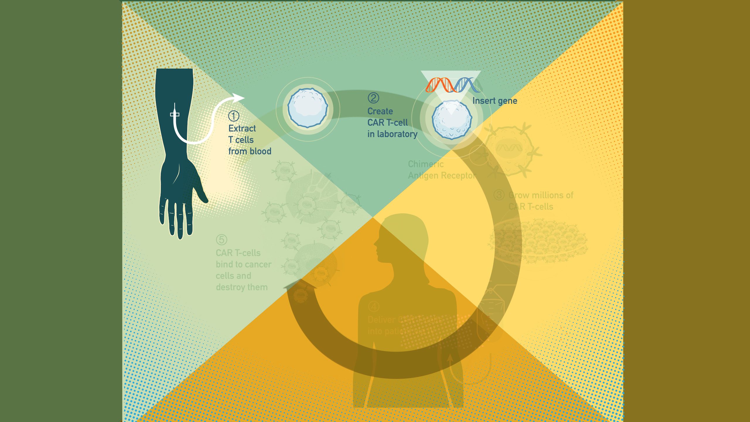 CAR T-cell therapy process infographic