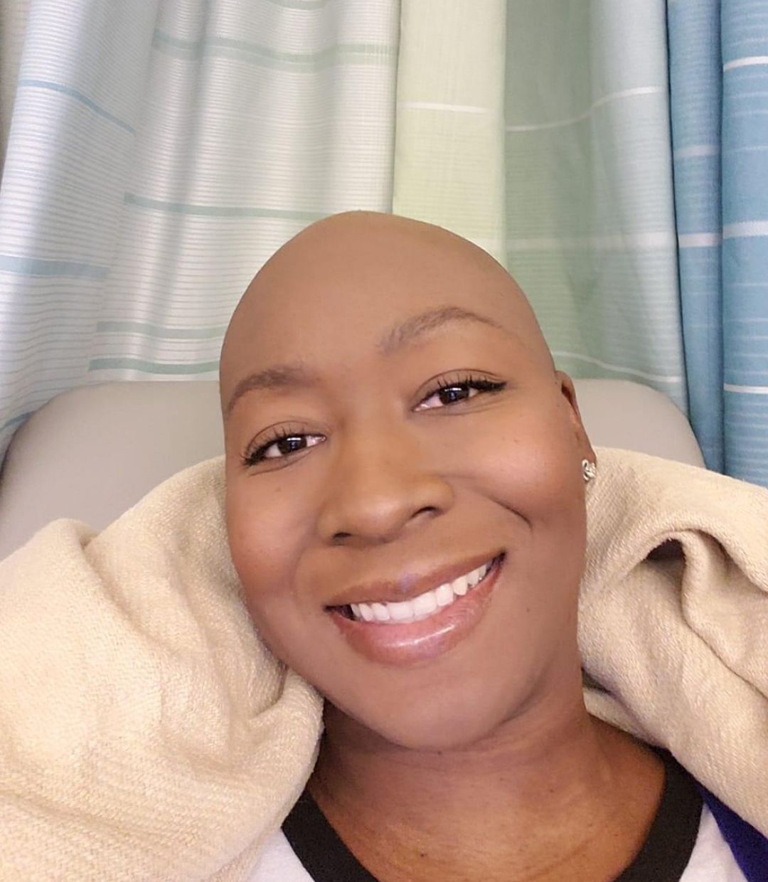 A woman without hair smiling.