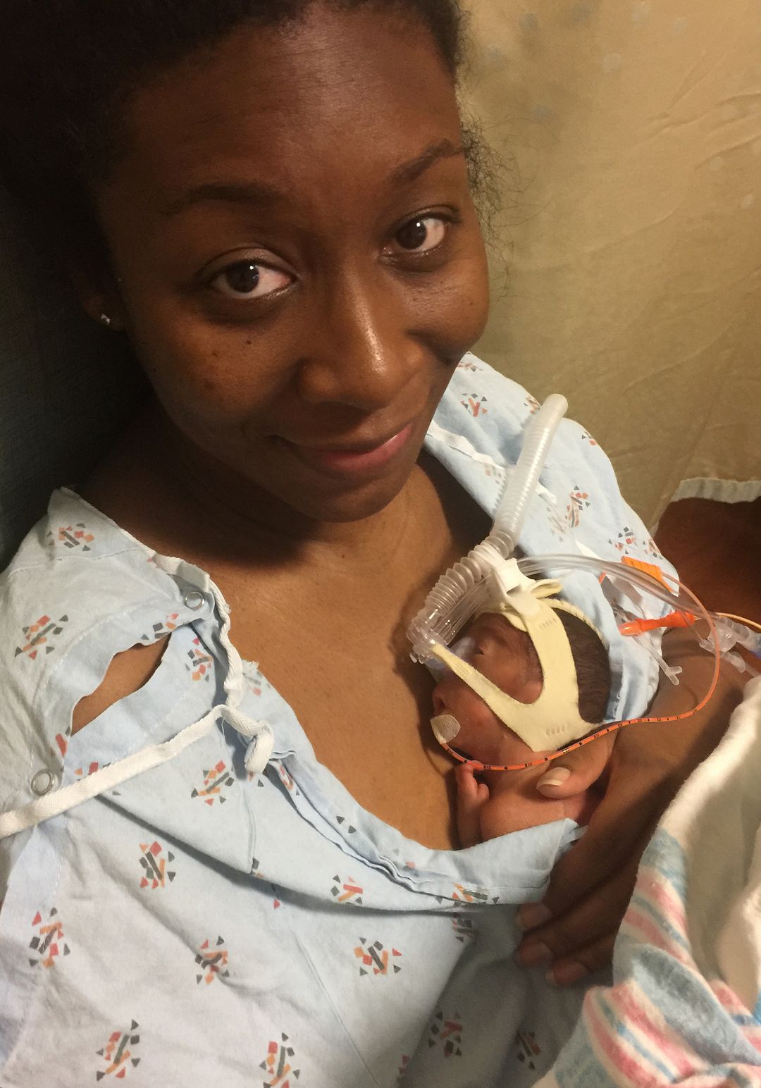 A woman in a hospital gown holding a very tiny baby with an oxygen tube to her chest.