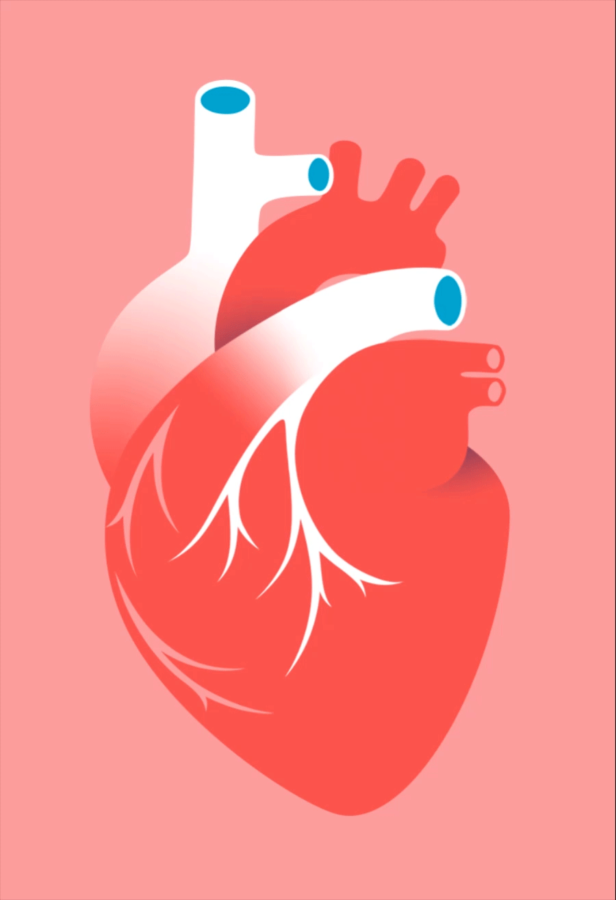 Graphic illustration of a heart showing, from top, the superior vena cava, the aorta, and the pulmonary artery.