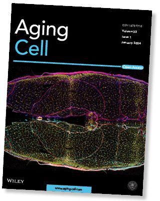 Aging Cell magazine cover with enlarged photo of cell