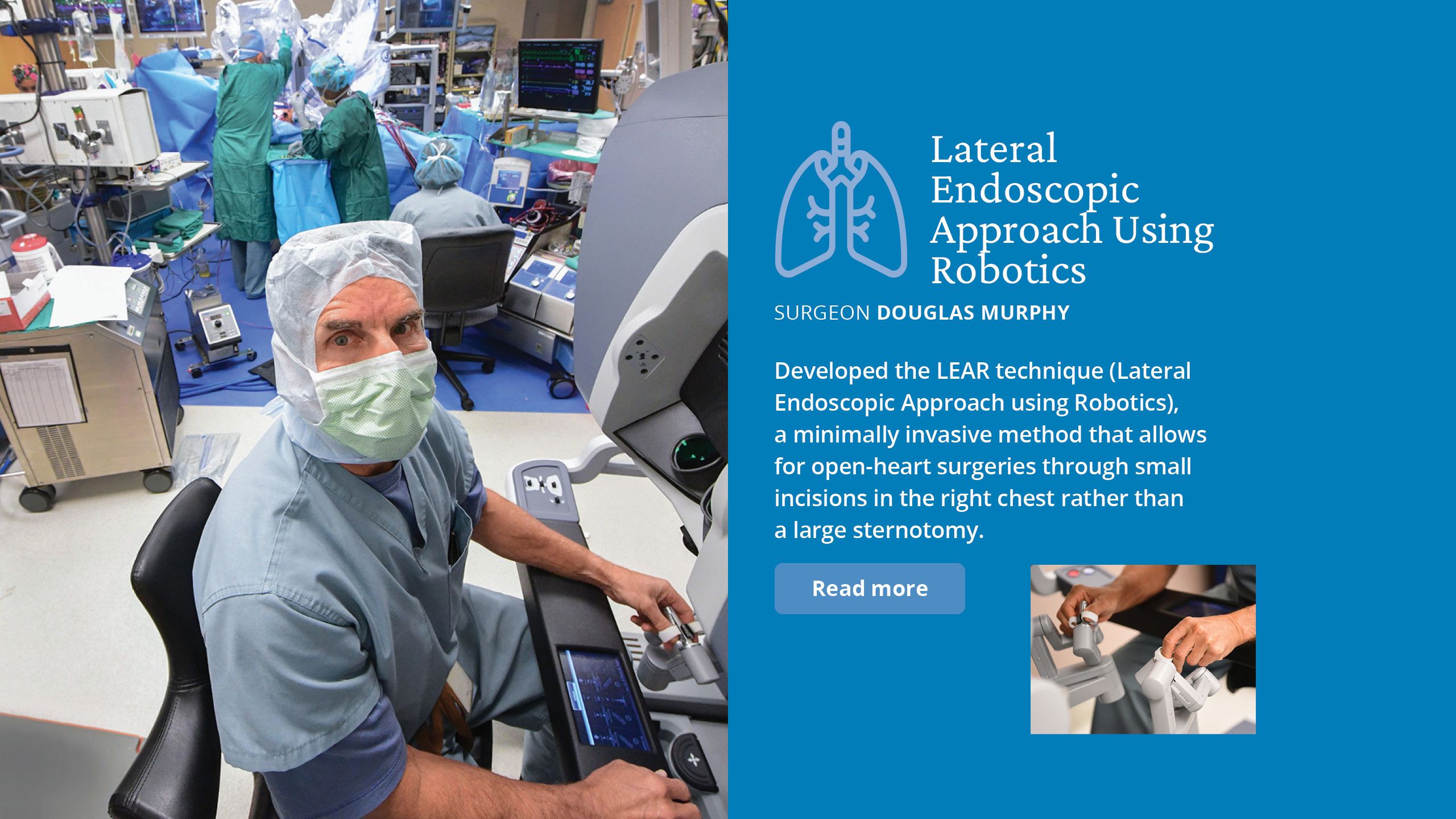 Lateral  Endoscopic  Approach using  Robotics SURGEON DOUGLAS MURPHY  Developed the&nbsp;LEAR technique (Lateral Endoscopic Approach using Robotics),  a minimally invasive method that  allows for open-heart surgeries through small incisions in the right chest rather than a large sternotomy. 