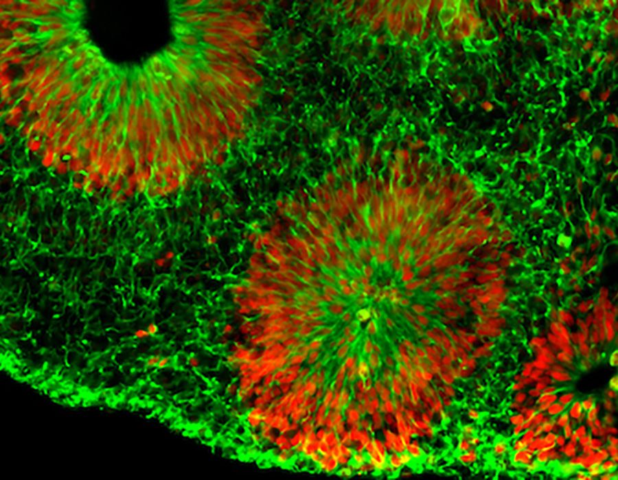 A microscopic view of a brain organoid that appears bright green with orange starburst patterns.