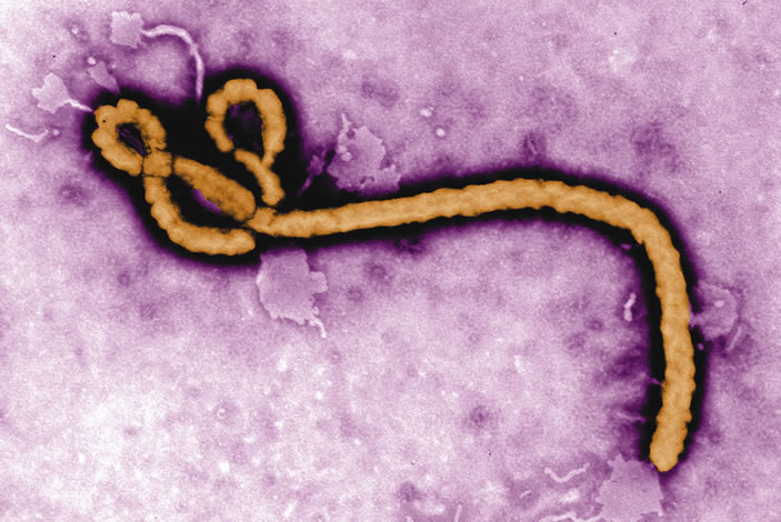 Ebola is spread through bodily fluids, such as blood, vomit, urine, saliva, and diarrhea, and requires direct contact. If you recover, you no longer have the virus and are likely to be immune to that strain. More: "Ebola 1-2-3"