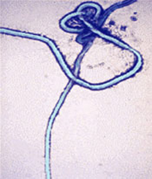 Ebola virus