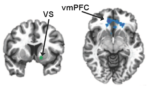 Aiding and Abetting Anhedonia: Impact of Inflammation on the Brain and  Pharmacological Implications