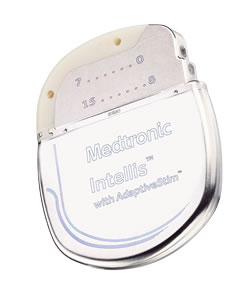 Medtronic's Intellis spinal cord stimulator algorithm delivers