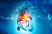American Heart Month: Changing the treatment landscape for atrial fibrillation