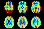 Emory researchers awarded $3.8 million to advance Alzheimer’s brain imaging 