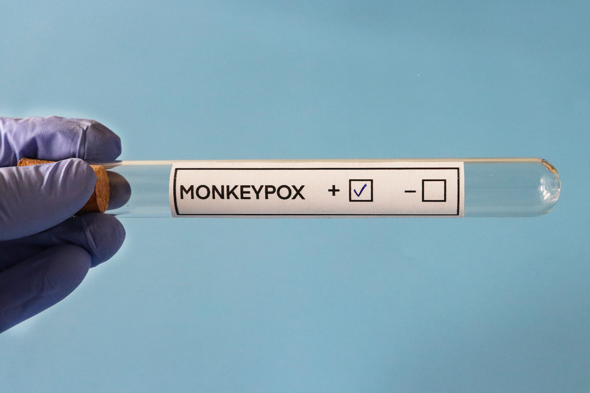 Vial indicating positive monkeypox test result
