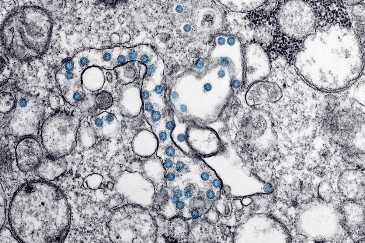 Coronavirus black/white/blue image
