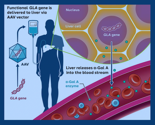 Explanation of Fabry disease gene therapy viral vector