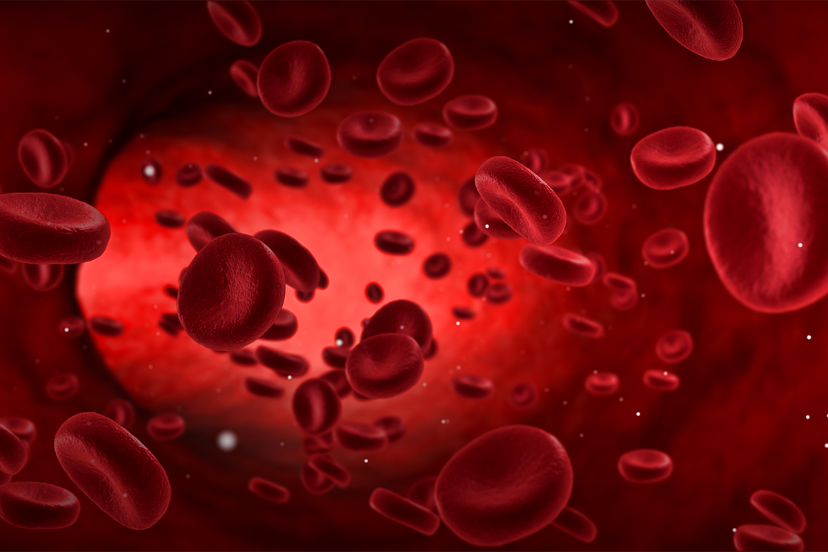 Image of aggregated red blood cells in COVID patient compared to patient with sepsis and healthy patient
