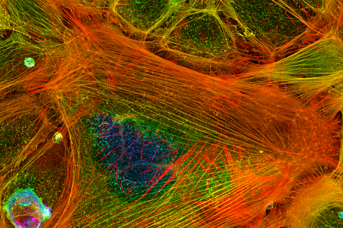 Confocal images showing actin filaments within a cell