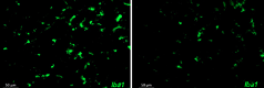 Image caption: Area covered by inflammatory microglia in the brain of Alzheimer’s disease mice without (left) and with EP2 targeting drug treatment (right)