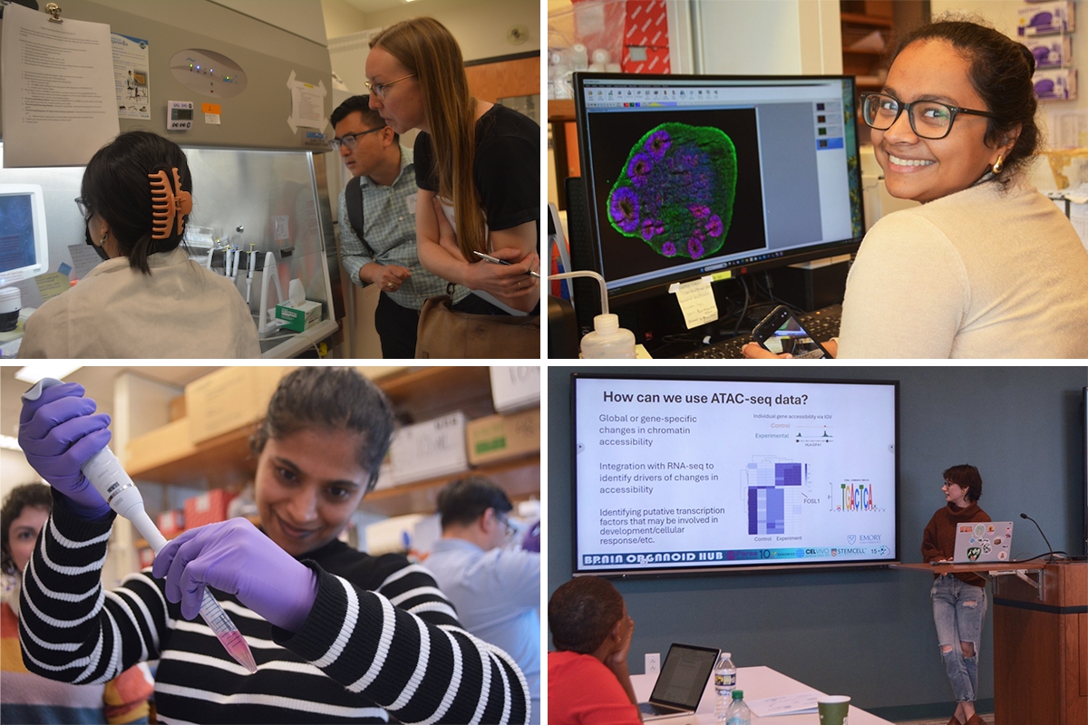 Scientists spent a week learning how to grow brain organoids and how to visualize and analyze the cells inside them.