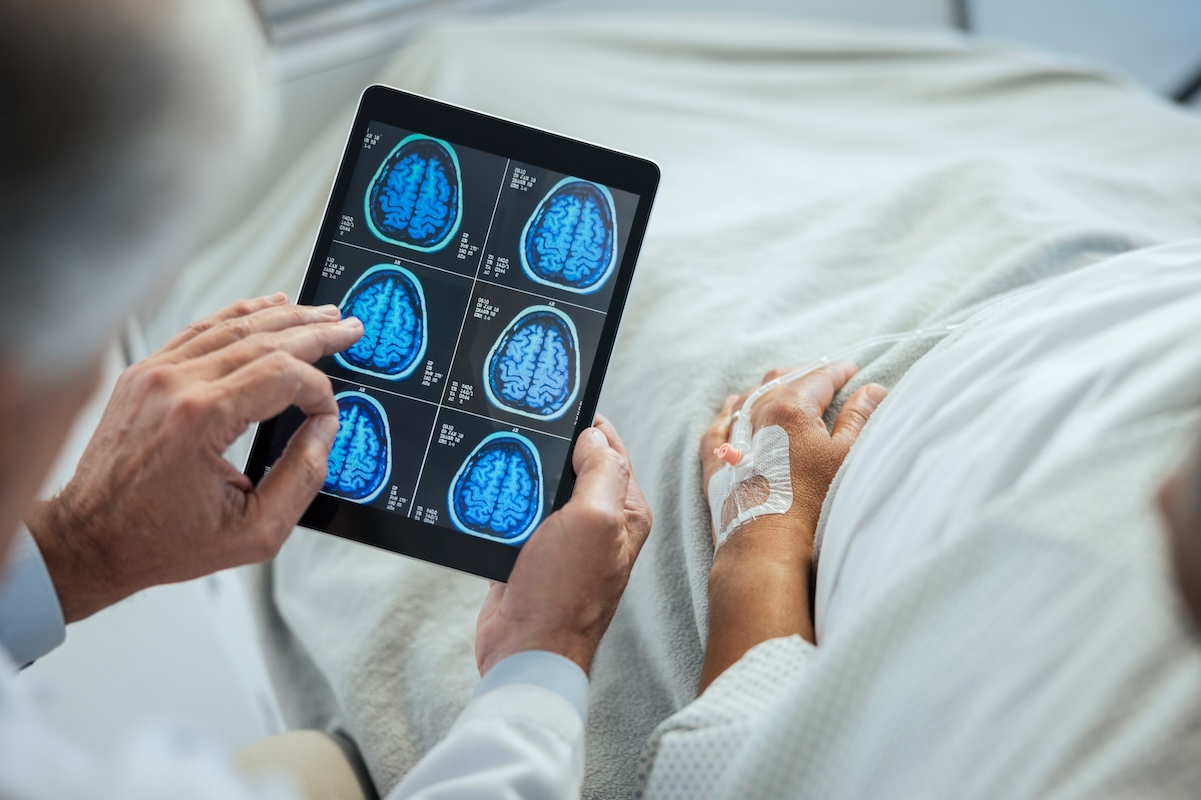 photo of doctor looking at brain scan at patient bedside