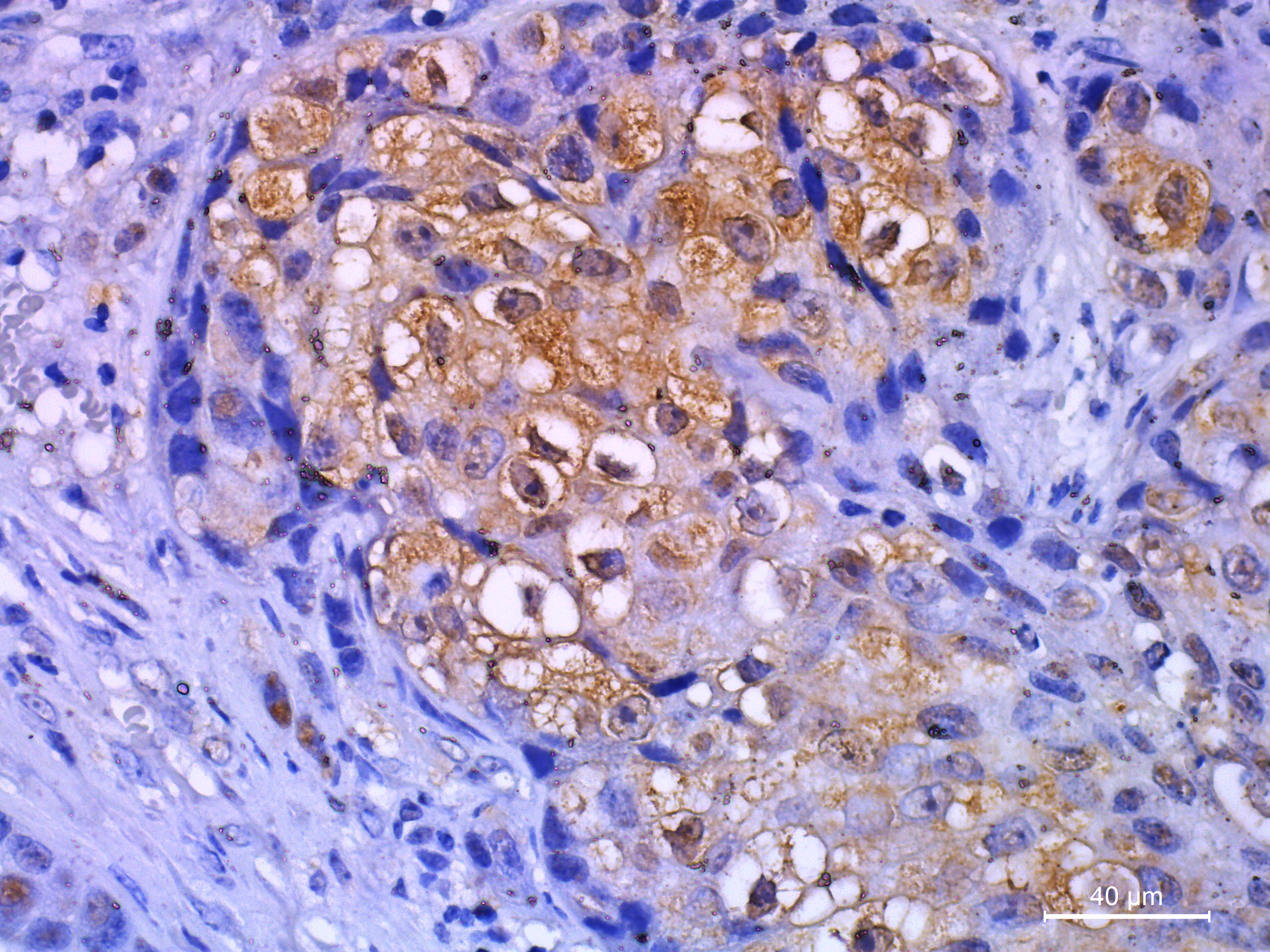 Histological slide stain image