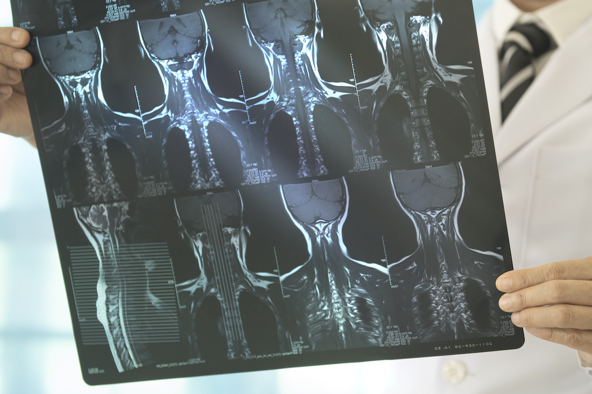 Radiological images