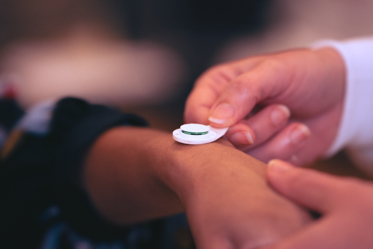 Microneedle patch technology 