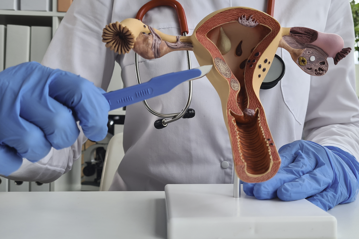 Medical model of a uterus